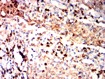 S100A8 Antibody