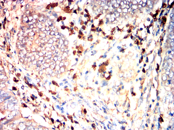 S100A8 Antibody