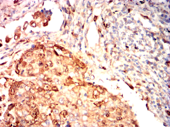 S100A8 Antibody