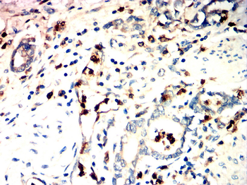 S100A8 Antibody