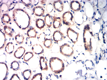 IGF-1 Antibody