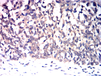IGF-1 Antibody