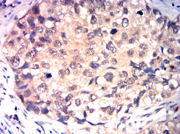 IGF-1 Antibody
