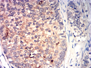 IGF-1 Antibody