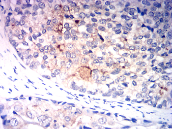 IGF-1 Antibody