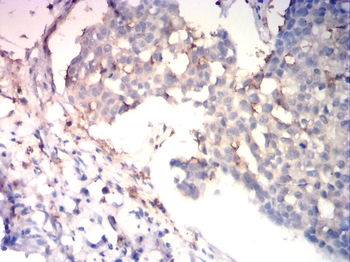 IGF-1 Antibody