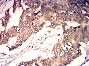 IGF-1 Antibody