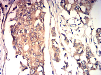IGF-1 Antibody