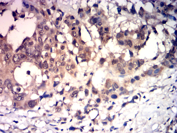 IGF-1 Antibody