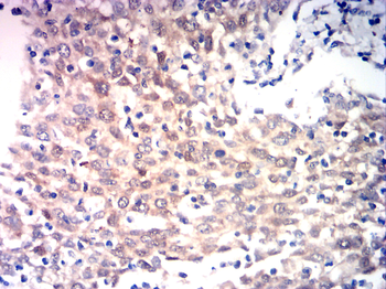 IGF-1 Antibody