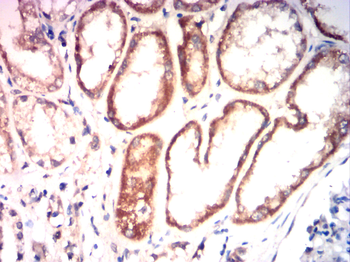 IGF-1 Antibody