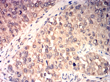 TIMP3 Antibody