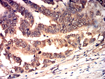 TIMP3 Antibody