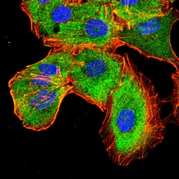 TIMP3 Antibody