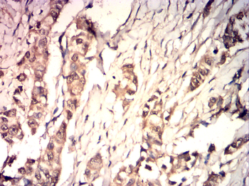 TIMP3 Antibody