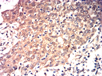 TIMP3 Antibody