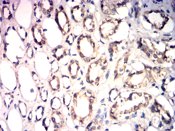 TIMP3 Antibody