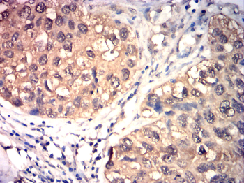 TIMP3 Antibody
