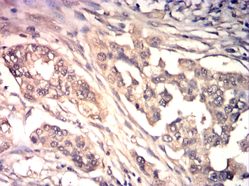 TIMP3 Antibody