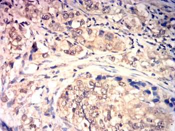 TIMP3 Antibody