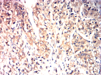 TIMP3 Antibody