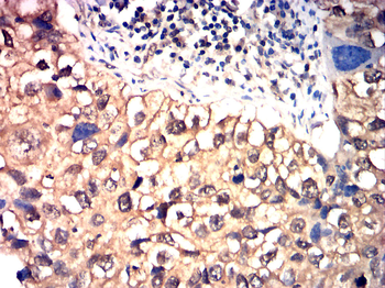 CD19 Antibody