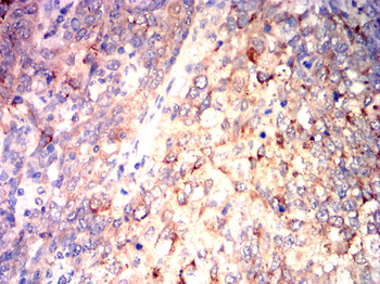 LAMP1 Antibody