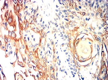 LAMP1 Antibody