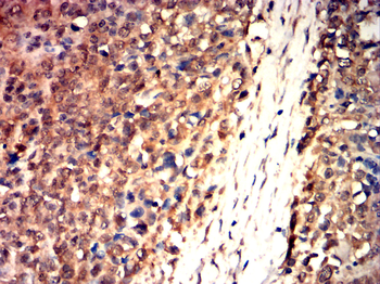 LAMP1 Antibody
