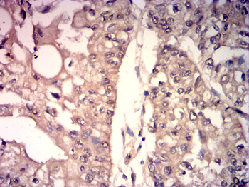 GSDME Antibody