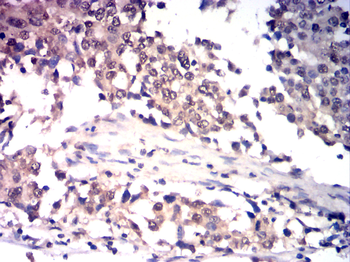 GSDME Antibody