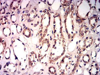 GSDME Antibody