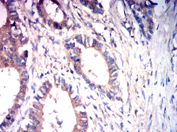 FGFR3 Antibody