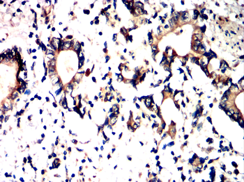 FGFR3 Antibody