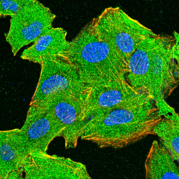FGFR3 Antibody