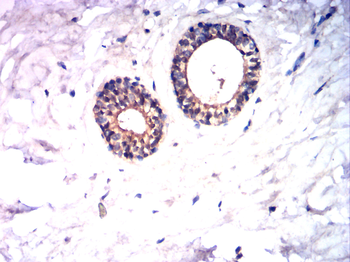 FGFR3 Antibody
