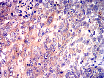 FGFR3 Antibody