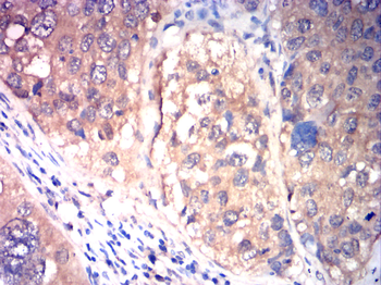 FGFR3 Antibody