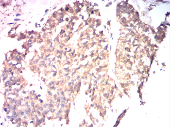 FGFR3 Antibody