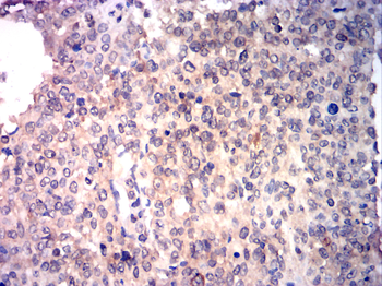 SENP1 Antibody