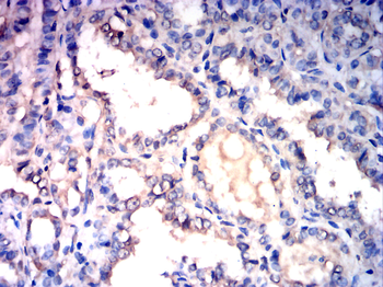 SENP1 Antibody