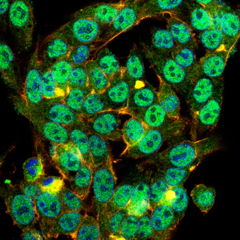 SENP1 Antibody