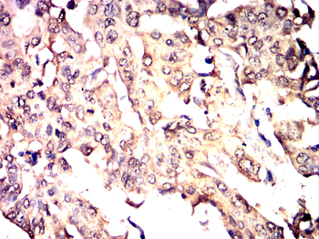 SENP1 Antibody