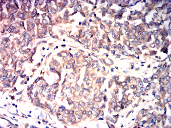 SENP1 Antibody