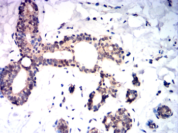 SENP1 Antibody
