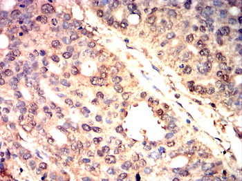 SENP1 Antibody