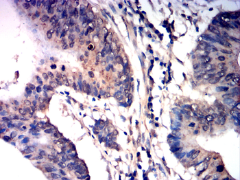 SENP1 Antibody