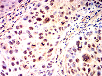 SENP1 Antibody