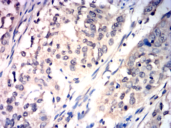 SENP1 Antibody