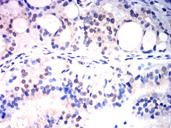 EGR1 Antibody